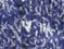 Lapis Blue